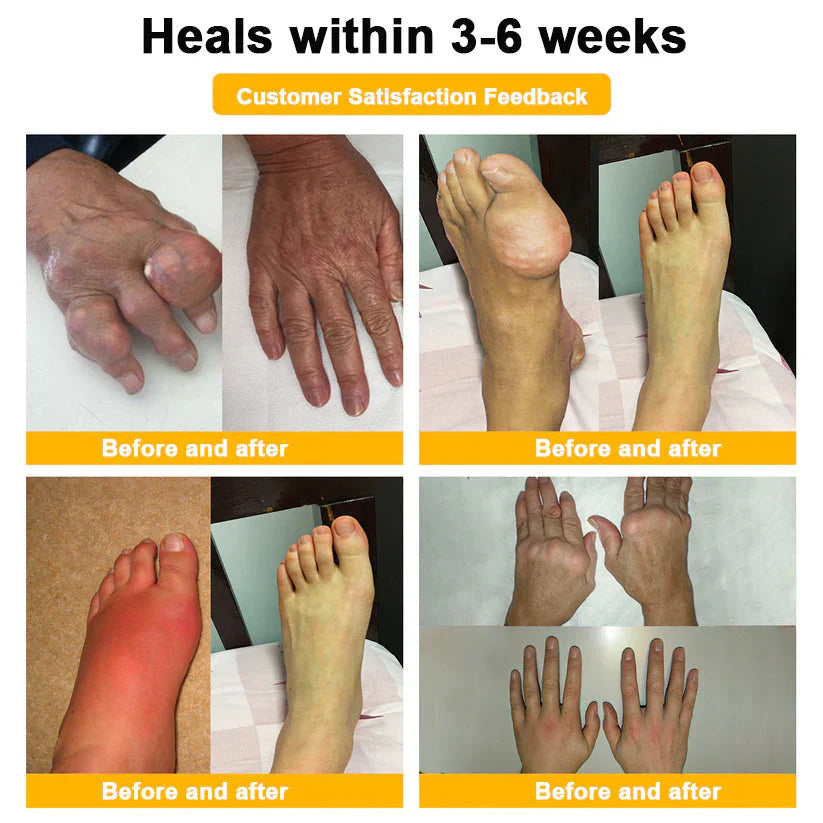 (š„Limited Time Discount Last Dayļ¼AQA⢠Botulinum & Bee Essence Pain Relief Bone Healing Cream