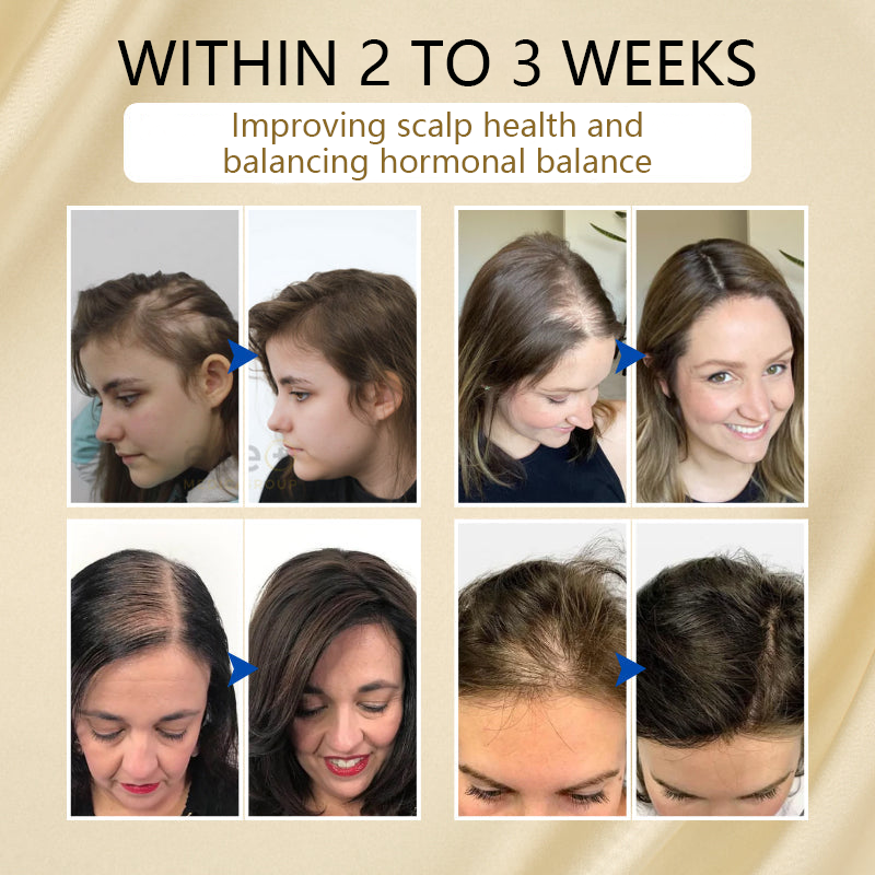 LOVILDS® VitaStrand Biotin Hair Growth Spray ✅ ✅ Thick, shiny hair in just a few weeks 🔥