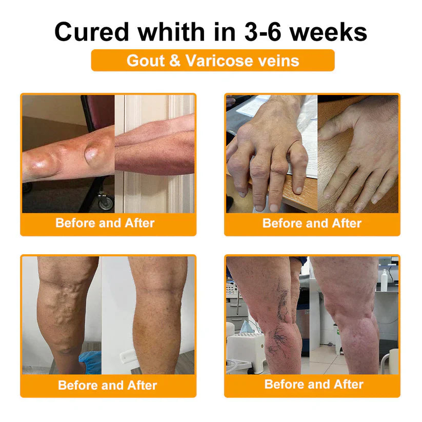 (š„Limited Time Discount Last Dayļ¼AQA⢠Botulinum & Bee Essence Pain Relief Bone Healing Cream