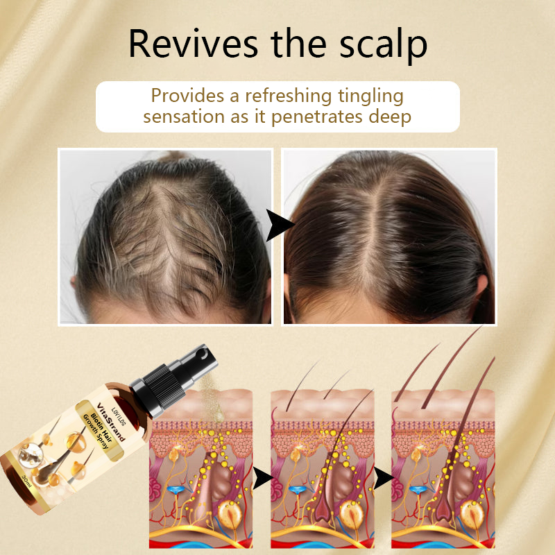 LOVILDS® VitaStrand Biotin Hair Growth Spray ✅ ✅ Thick, shiny hair in just a few weeks 🔥
