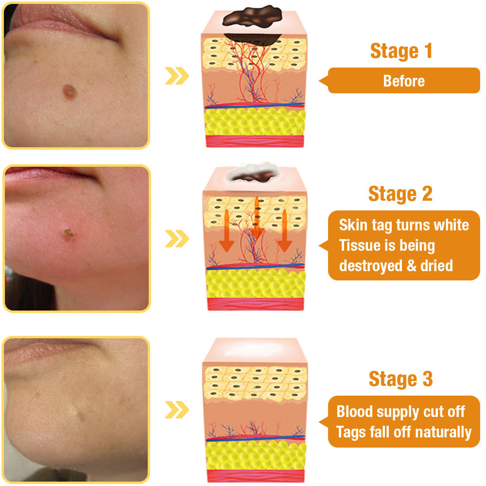 ✨𝐋𝐚𝐬𝐭 𝐃𝐚𝐲 𝐃𝐢𝐬𝐜𝐨𝐮𝐧𝐭: 87% 𝐎𝐅𝐅 🐝AQA™ TagRecede Bees Treatment Spray