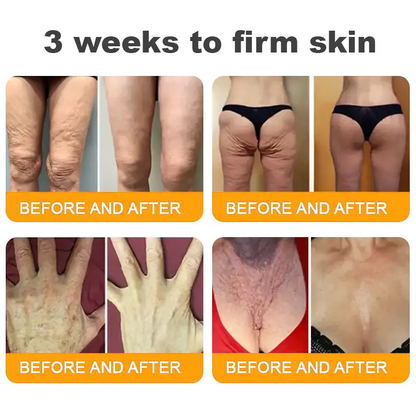 Made and Shipped from USA ✨ TAILEDEN® Bee Venom Skin Restoration Cream ⏰ LAST DAY 80% OFF