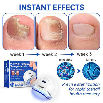 ✨Last Day Discount -70%OFF✨QIAWI™ PureNail Fungus Laser Device-🗽Made and Shipped from USA👏