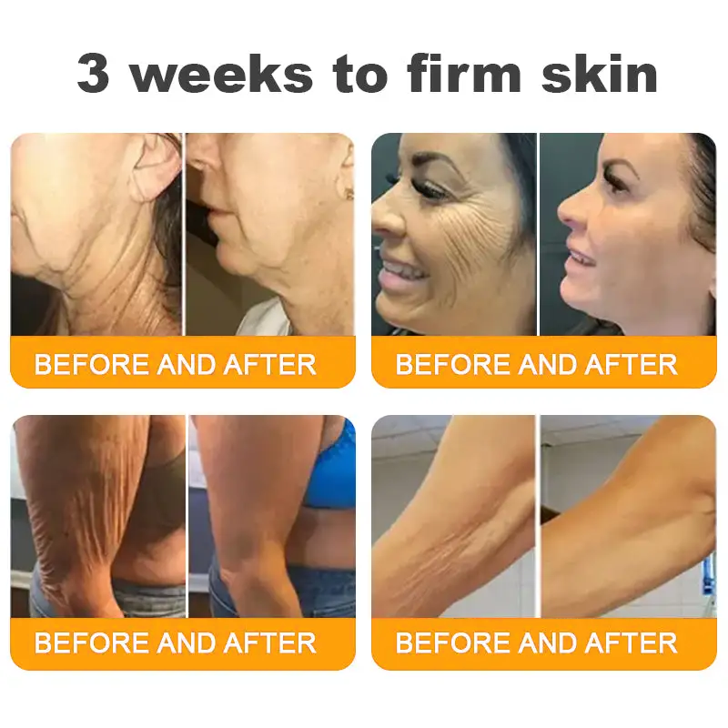 Made and Shipped from USA ✨ TAILEDEN® Bee Venom Skin Restoration Cream ⏰ LAST DAY 80% OFF