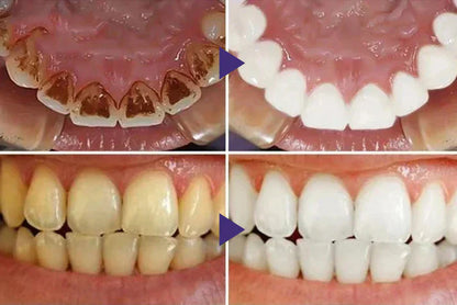 LOVILDS™ Gum Care Gel – Restore & Strengthen Your Gums