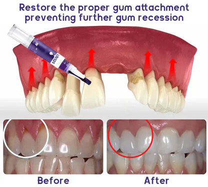 LOVILDS™ Gum Care Gel – Restore & Strengthen Your Gums