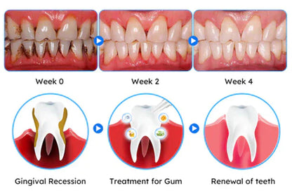 LOVILDS™ Gum Care Gel – Restore & Strengthen Your Gums