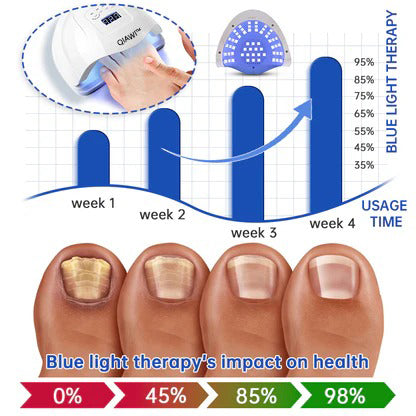 ✨Last Day Discount -70%OFF✨QIAWI™ PureNail Fungus Laser Device-🗽Made and Shipped from USA👏